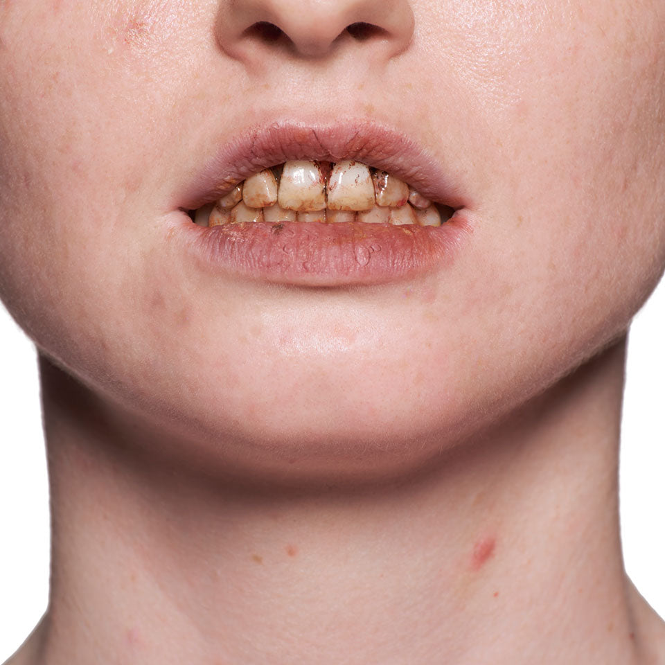 Maquiagem para Dentes Kryolan — detalhe 2